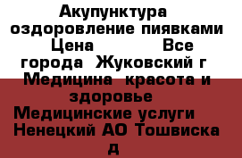 Акупунктура, оздоровление пиявками › Цена ­ 3 000 - Все города, Жуковский г. Медицина, красота и здоровье » Медицинские услуги   . Ненецкий АО,Тошвиска д.